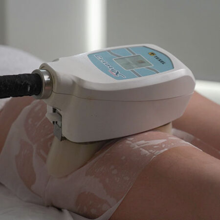 Estética-Corporal-_0007_Criolipolisis