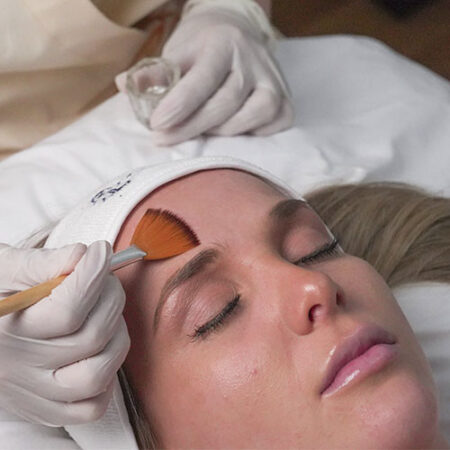 Estética Facial_0000_Peeling