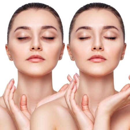 Relleno de Ojeras Relleno de Ojeras - Kaya Kalpa - Centro de Spa y Belleza en Rosario